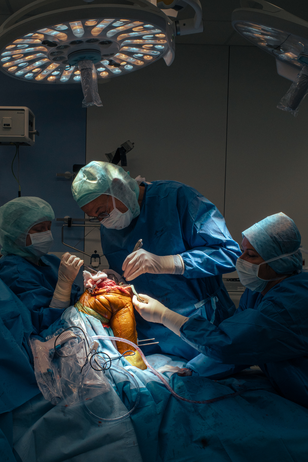 3 months in a surgery room.